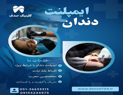 ایمپلنت دندان در مشهد – از دم قسط، بدون سود و بهره!