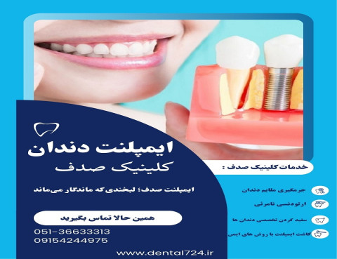ایمپلنت دندان در مشهد ، کلینیک صدف